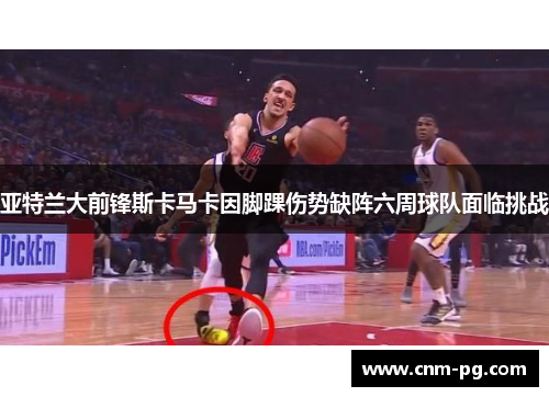 亚特兰大前锋斯卡马卡因脚踝伤势缺阵六周球队面临挑战